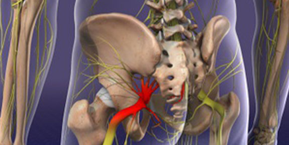 Sciatica Care Concord